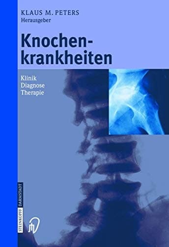 Knochenkrankheiten Klinik, Diagnose, Therapie
