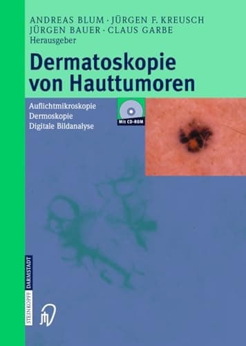 Dermatoskopie von Hauttumoren Auflichtmikroskopie ; Dermoskopie ; digitale Bildanalyse ; mit 28 Tabellen