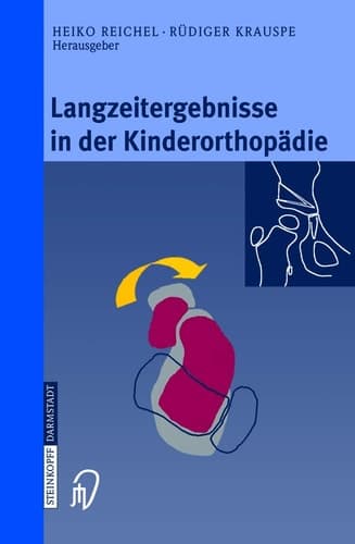 Langzeitergebnisse in Der Kinderorthopädie