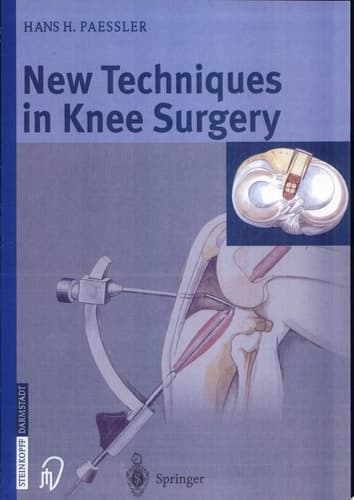 New Techniques in Knee Surgery