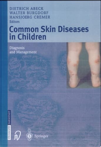 Common Skin Diseases in Children Diagnosis and Management