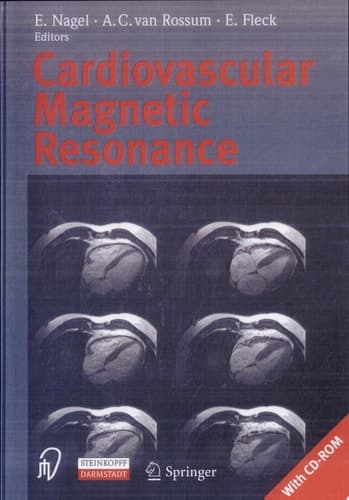 Cardiovascular Magnetic Resonance 30 Tables