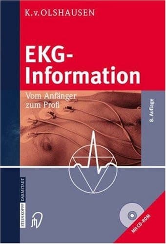 EKG-Information: Vom Anfänger zum Profi (German Edition)