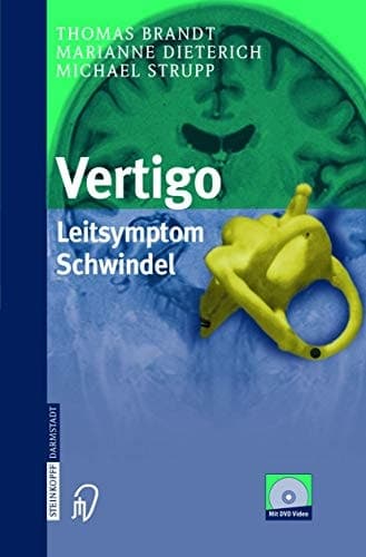 Vertigo: Leitsymptom Schwindel (German Edition)