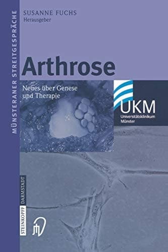 Arthrose