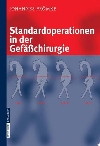 Standardoperationen in der Gefässchirurgie