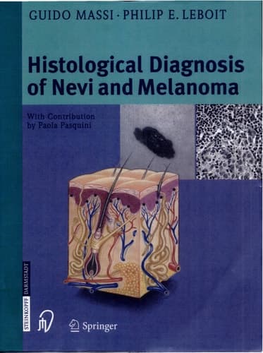 Histological Diagnosis Of Nevi And Melanoma