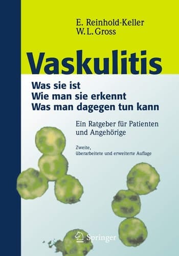 Vaskulitis Was ist sie - Wie man sie erkennt - Was man dagegen tun kann