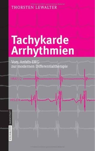 Tachykarde Arrhythmien Vom Anfalls-EKG zur modernen Differentialtherapie