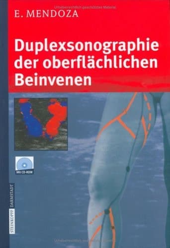 Duplexsonographie der oberflächlichen Beinvenen (German Edition)