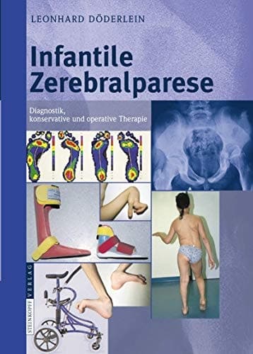 Infantile Zerebralparese Diagnostik, konservative und operative Therapie
