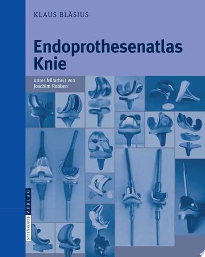 Endoprothesenatlas Knie