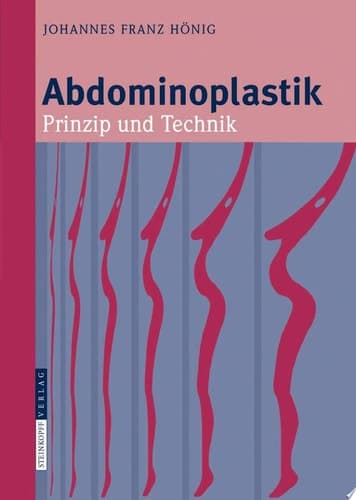 Abdominoplastik Prinzip und Technik