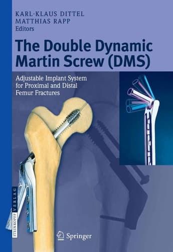 The Double Dynamic Martin Screw (DMS) Adjustable Implant System for Proximal and Distal Femur Fractures