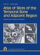 Atlas de Coupes Sériés de L'os Temporal Et de Sa Région : Anatomie Et Tomodensitométrie. Anglais
