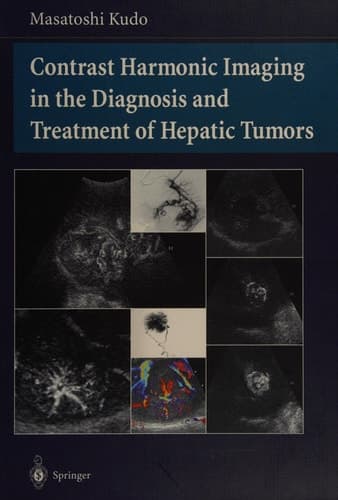 Contrast Harmonic Imaging in the Diagnosis and Treatment of Hepatic Tumors