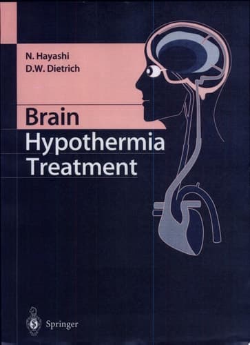Brain Hypothermia Treatment