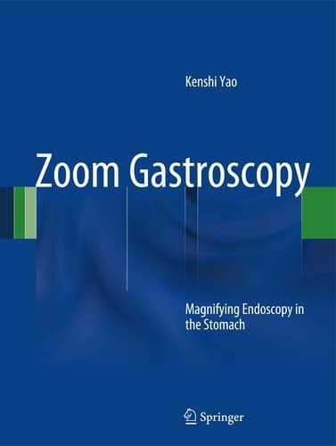 Zoom Gastroscopy Magnifying Endoscopy in the Stomach