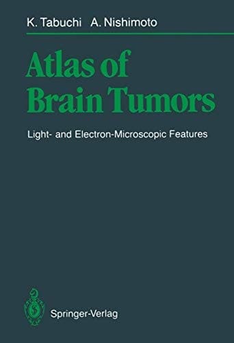 Atlas of Brain Tumors: Light- and Electron-Microscopic Features