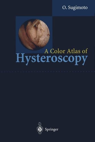 a_color_atlas_of_hysteroscopy