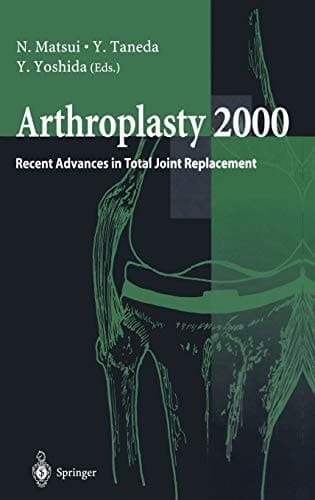 Arthroplasty 2000: Recent Advances in Total Joint Replacement