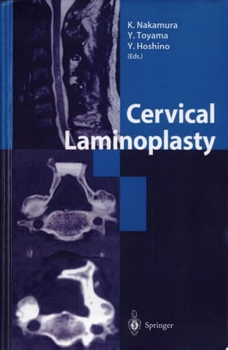 Cervical Laminoplasty