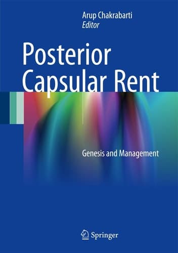 Posterior Capsular Rent Genesis and Management