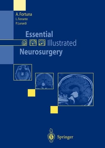 Essential Illustrated Neurosurgery