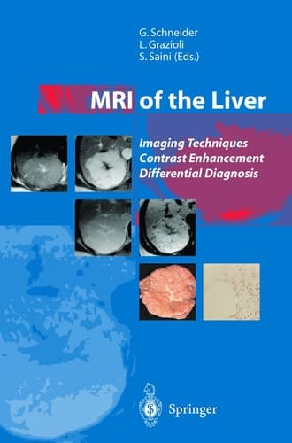 MRI of the Liver: Imaging Techniques Contrast Enhancement Differential Diagnosis