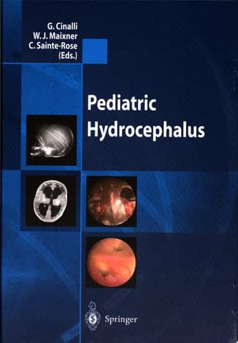 Pediatric Hydrocephalus