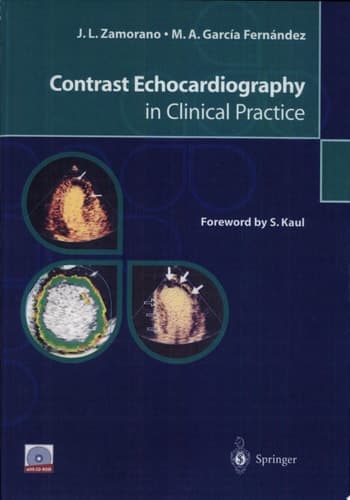 Contrast Echocardiography in Clinical Practice