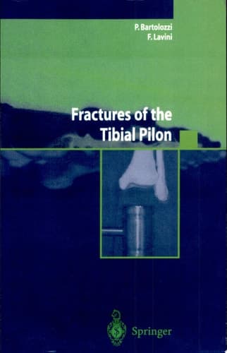 Fractures of the Tibial Pilon