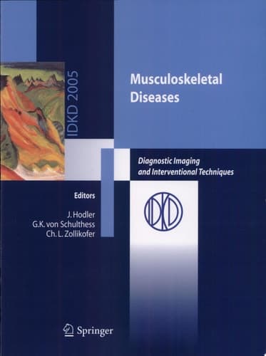 Musculoskeletal Diseases Diagnostic Imaging and Interventional Techniques