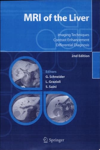 MRI of the Liver Imaging Techniques, Contrast Enhancement, Differential Diagnosis