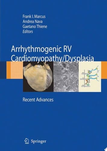 Arrhythmogenic RV Cardiomyopathy/Dysplasia Recent Advances