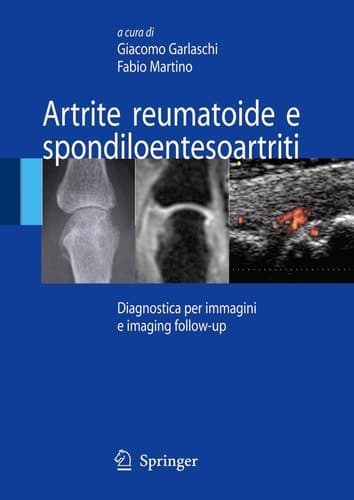 Artrite reumatoide e spondiloentesoartriti Diagnostica per immagini ed imaging follow-up