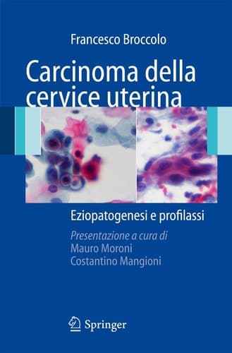 Carcinoma della cervice uterina Eziopatogenesi e profilassi