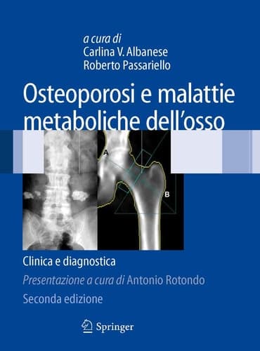 Osteoporosi e malattie metaboliche dell'osso Clinica e diagnostica