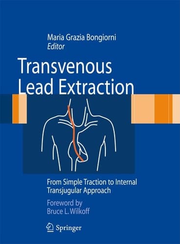 Transvenous Lead Extraction From Simple Traction to Internal Transjugular Approach