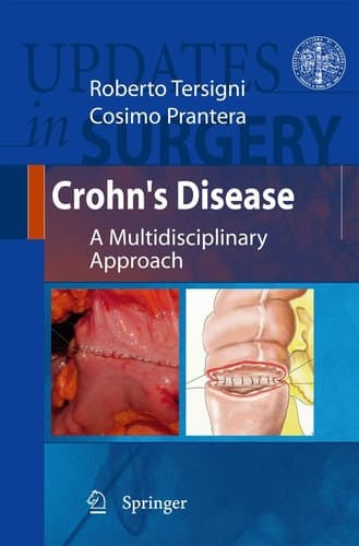 Crohn's Disease A Multidisciplinary Approach
