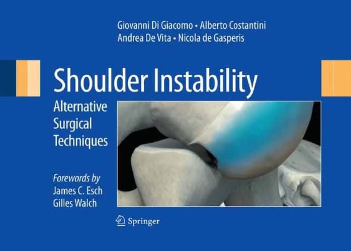 Shoulder Instability Alternative Surgical Techniques