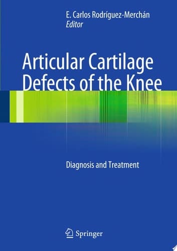 Articular Cartilage Defects of the Knee Diagnosis and Treatment