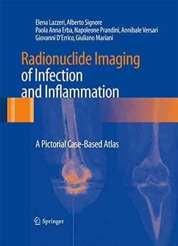 Radionuclide Imaging of Infection and Inflammation A Pictorial Case-Based Atlas