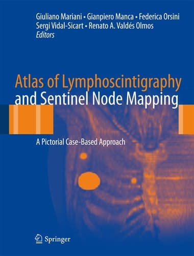 Atlas of Lymphoscintigraphy and Sentinel Node Mapping A Pictorial Case-Based Approach