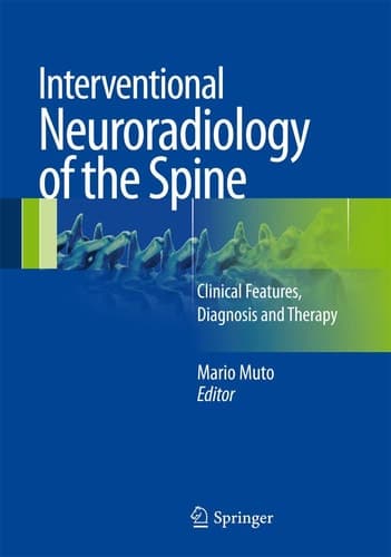 Interventional Neuroradiology of the Spine Clinical Features, Diagnosis and Therapy