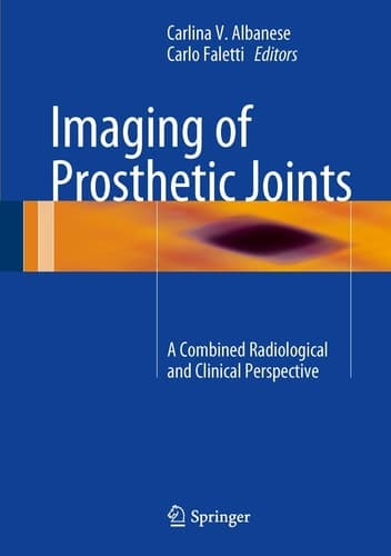 Imaging of Prosthetic Joints A Combined Radiological and Clinical Perspective