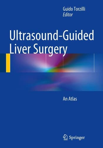 Ultrasound-Guided Liver Surgery An Atlas