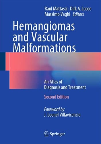 Hemangiomas and Vascular Malformations An Atlas of Diagnosis and Treatment