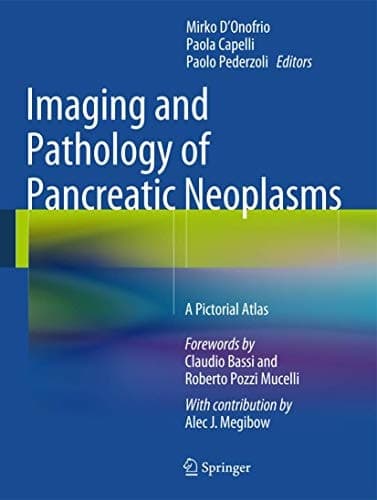 Imaging and Pathology of Pancreatic Neoplasms A Pictorial Atlas