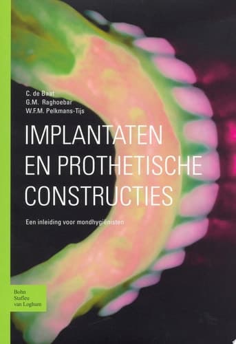 Implantaten en prothetische constructies Een inleiding voor mondhygiënisten